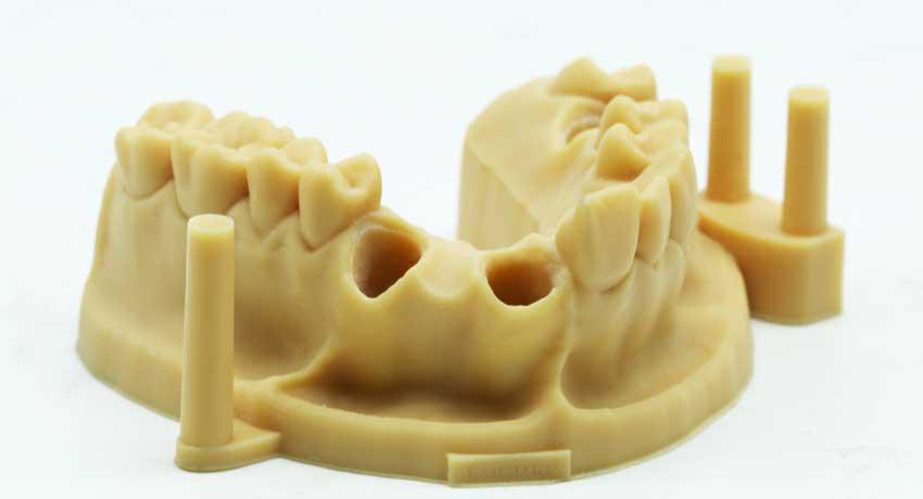 Dental models printed in 3D