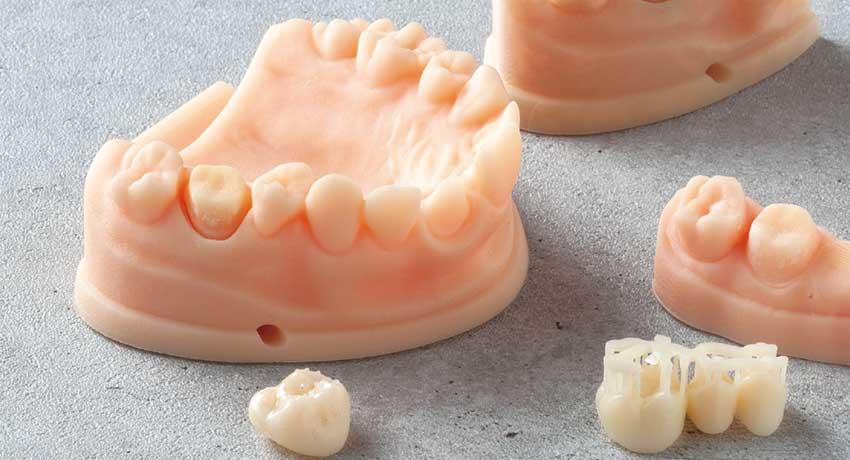 Stampante 3D per il dentale